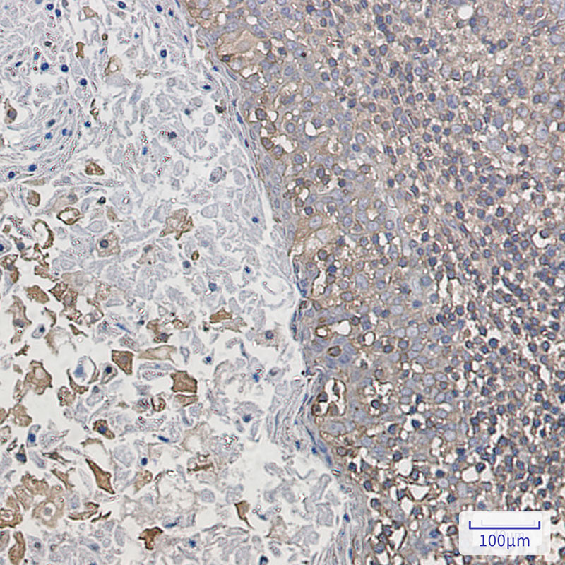 Rabbit Monoclonal Antibody to ARPC2