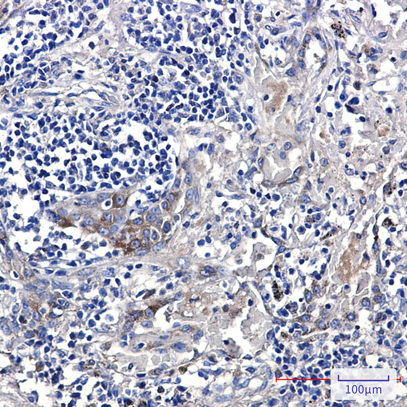 Rabbit Monoclonal Antibody to ERAP1