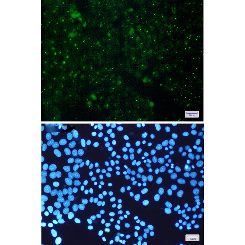 Rabbit Monoclonal Antibody to Aryl Hydrocarbon Receptor