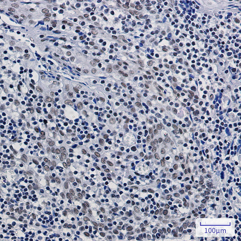 Rabbit Monoclonal Antibody to ASH2L