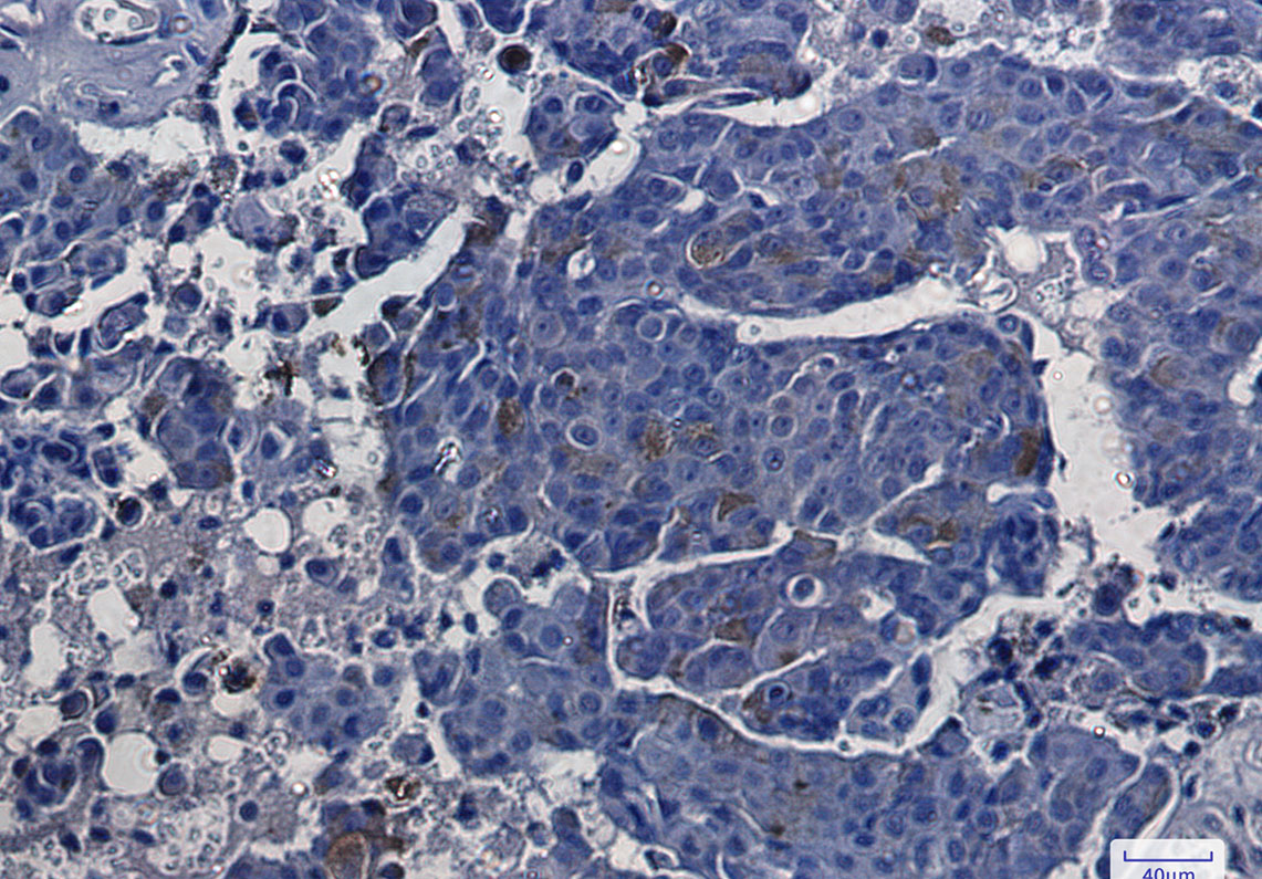 Rabbit Monoclonal Antibody to ASS1