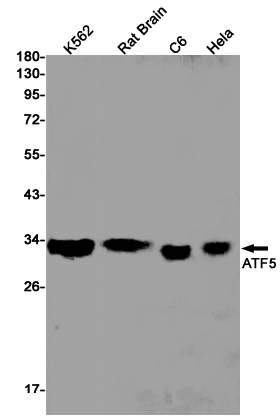 Rabbit Monoclonal Antibody to ATF5