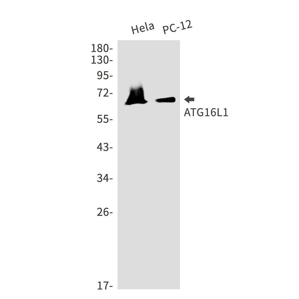 ATG16L1