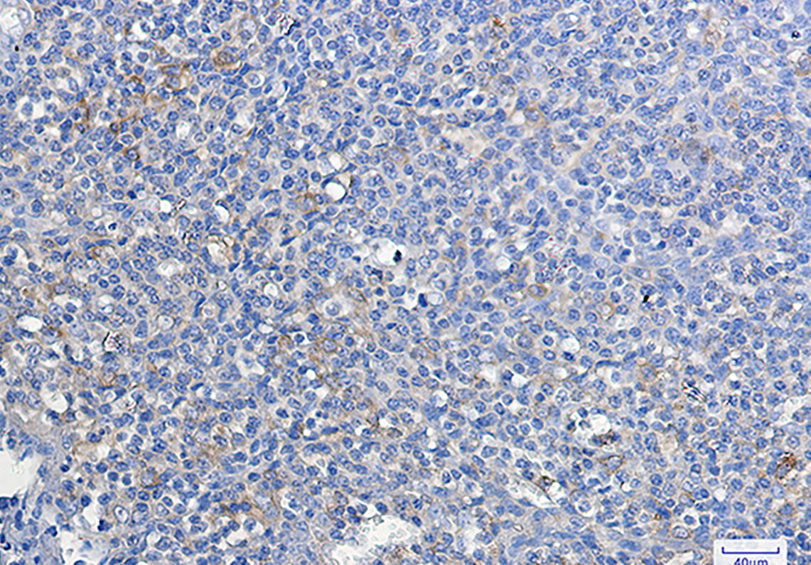 Rabbit Monoclonal Antibody to ATG3