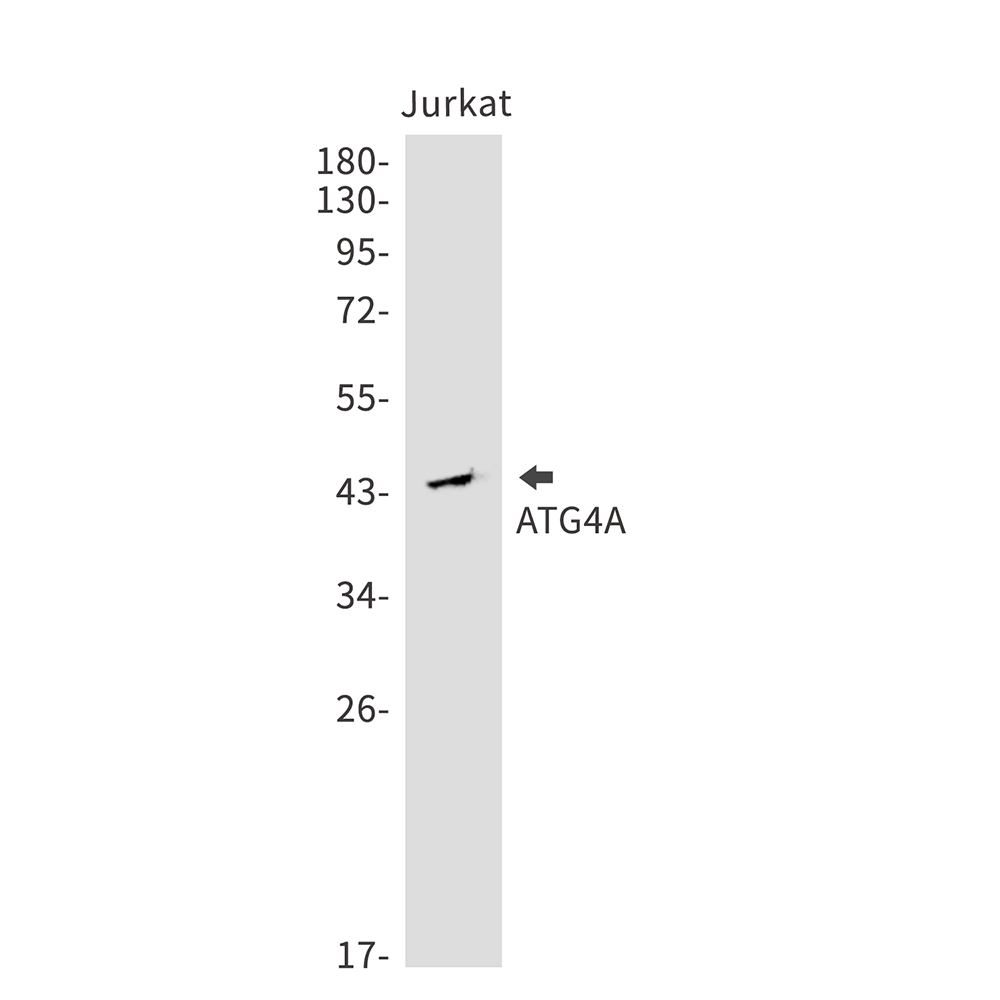 ATG4A