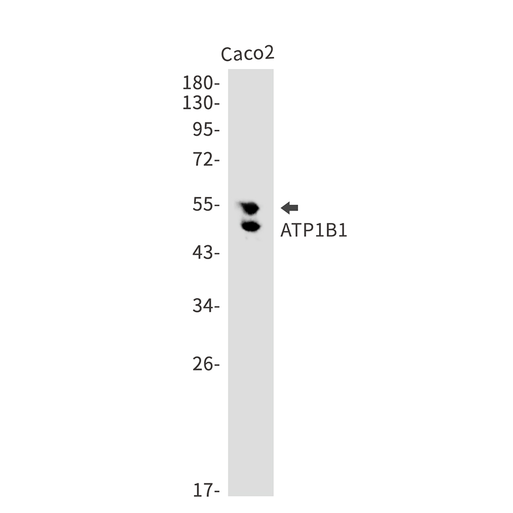 ATP1B1