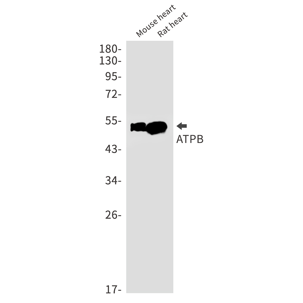 Rabbit Monoclonal Antibody to ATPB_ATPB-远泰生物抗体定制