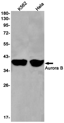 Aurora B