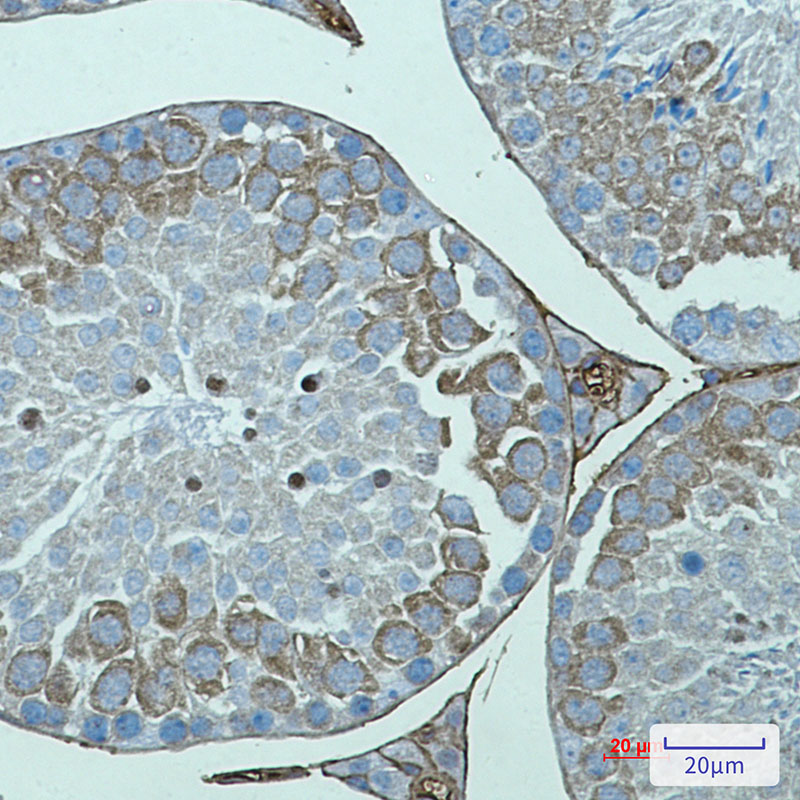 Rabbit Monoclonal Antibody to AVEN