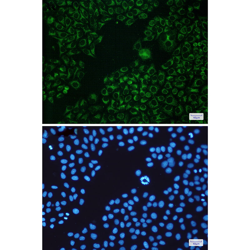 Rabbit Monoclonal Antibody to Bad