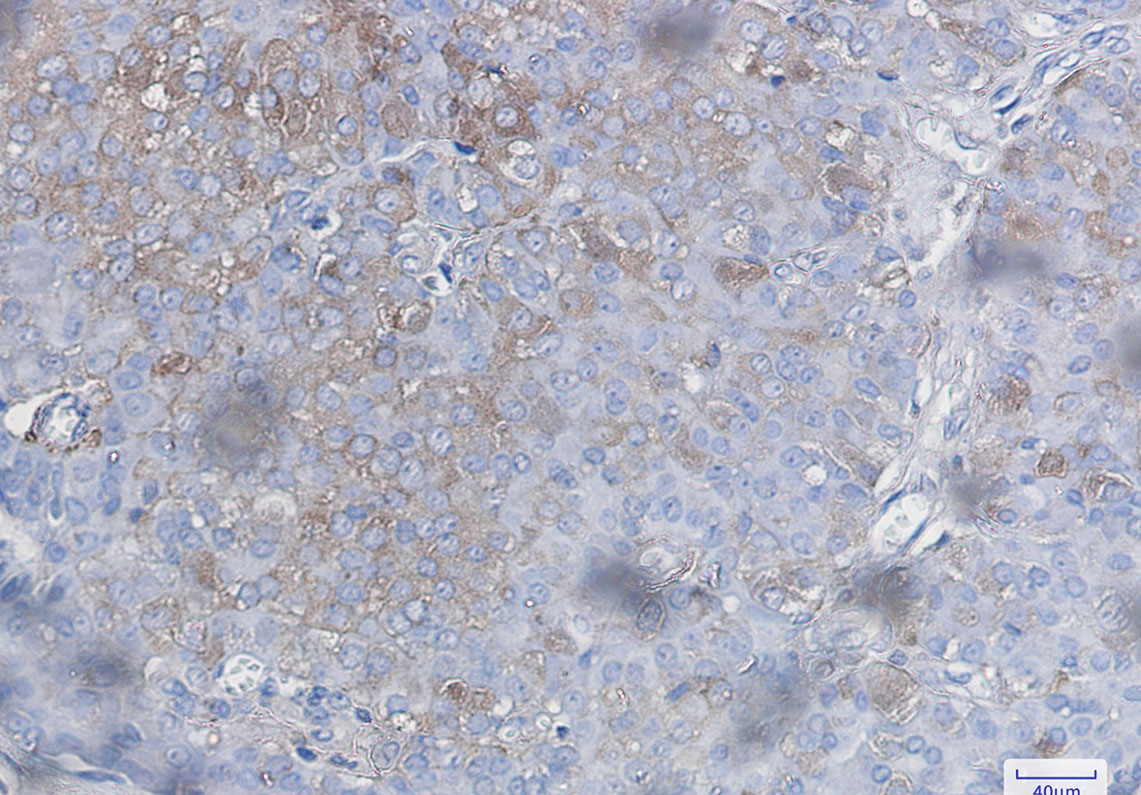 Rabbit Monoclonal Antibody to Bad