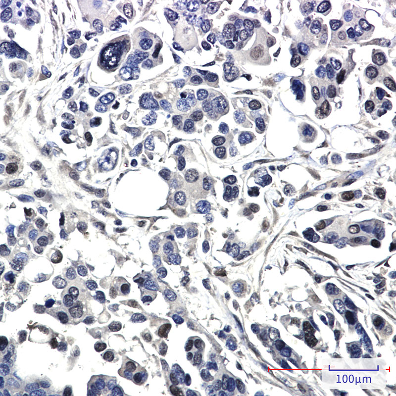 Rabbit Monoclonal Antibody to BAG1