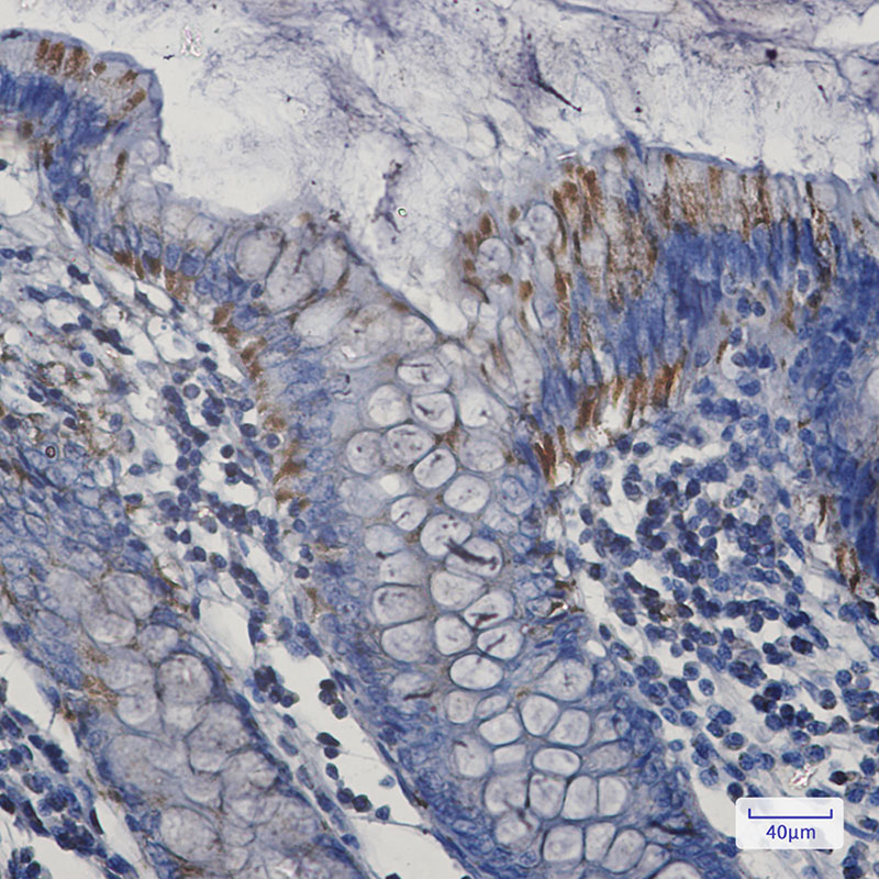 Rabbit Monoclonal Antibody to Bak