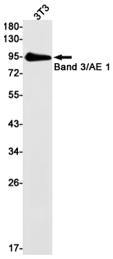 Rabbit Monoclonal Antibody to Band 3