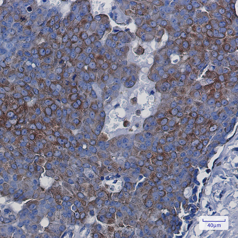 Rabbit Monoclonal Antibody to BAP31
