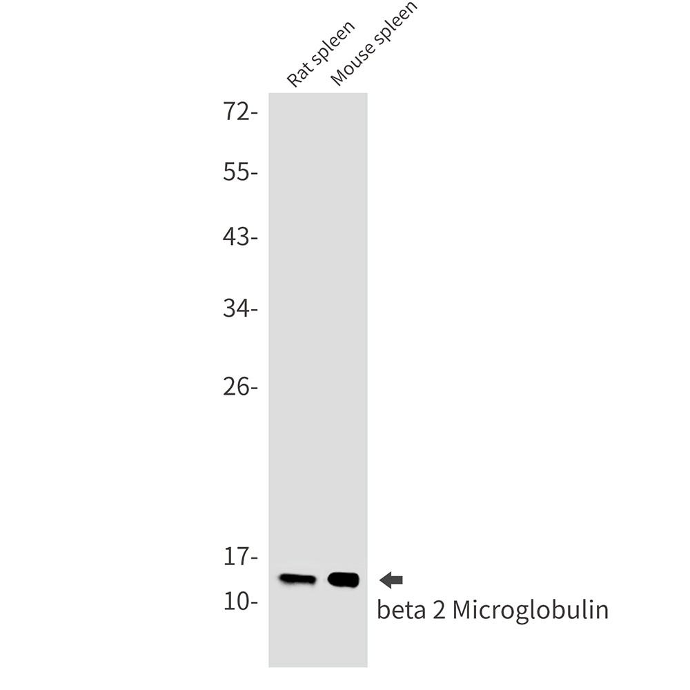 beta 2 Microglobulin
