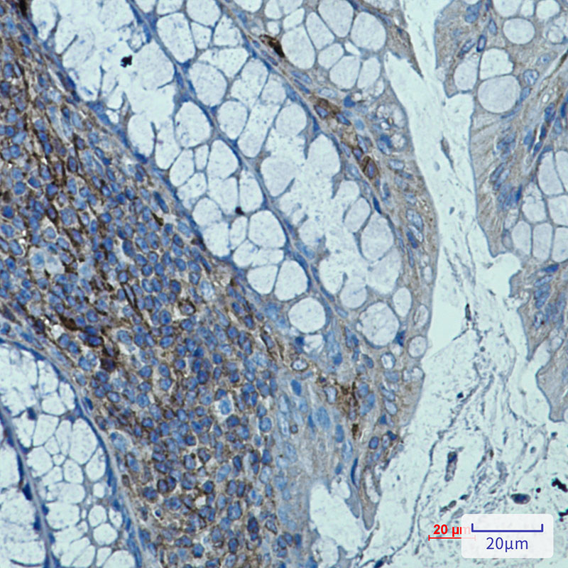 Rabbit Monoclonal Antibody to beta 2 Microglobulin
