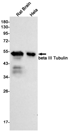 Rabbit Monoclonal Antibody to beta III Tubulin