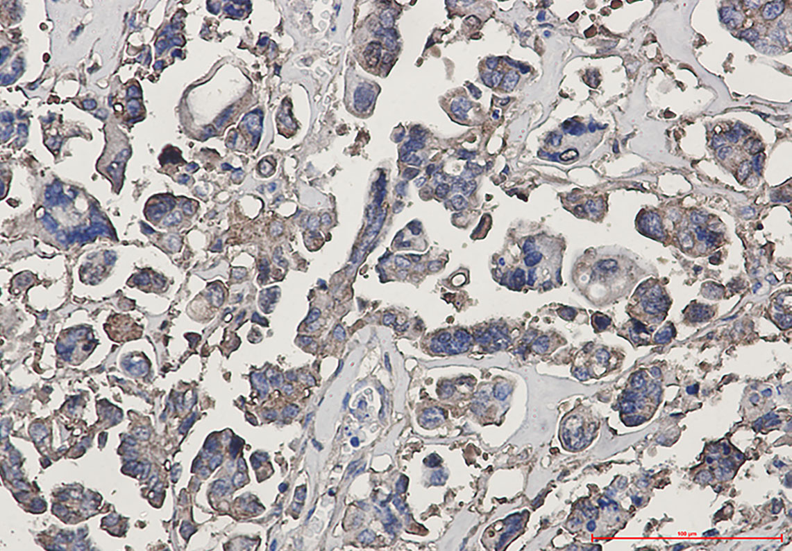 Rabbit Monoclonal Antibody to beta III Tubulin