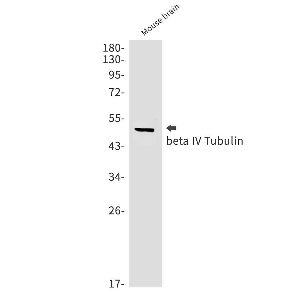 beta IV Tubulin
