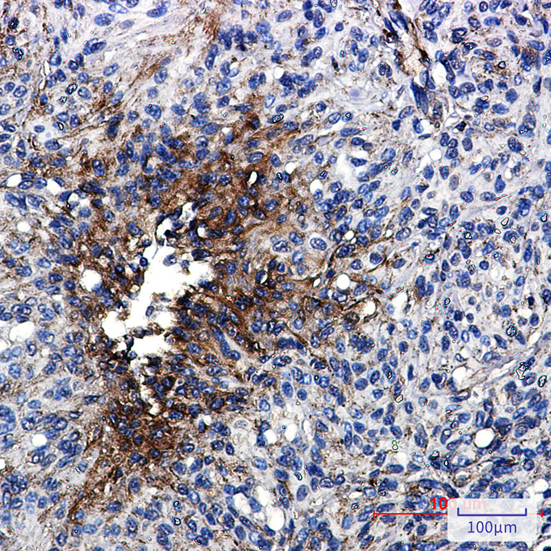 Rabbit Monoclonal Antibody to beta IV Tubulin