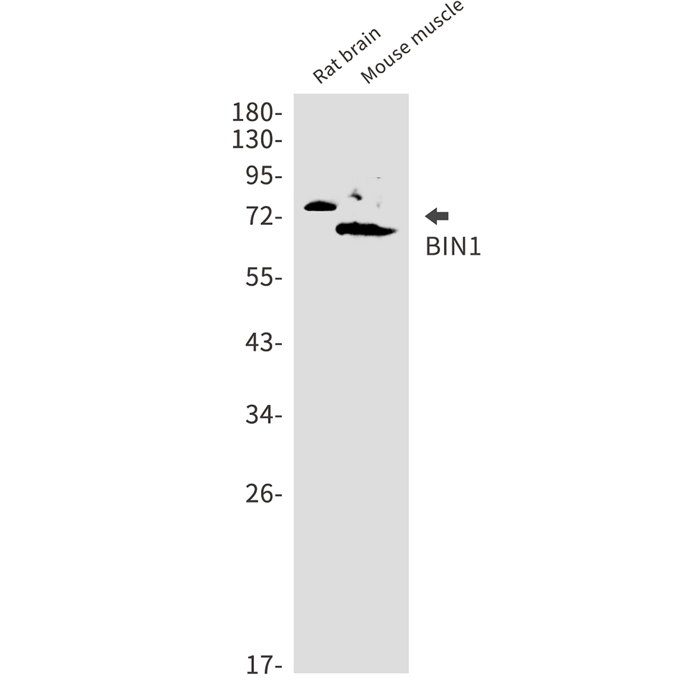 Rabbit Monoclonal Antibody to BIN1
