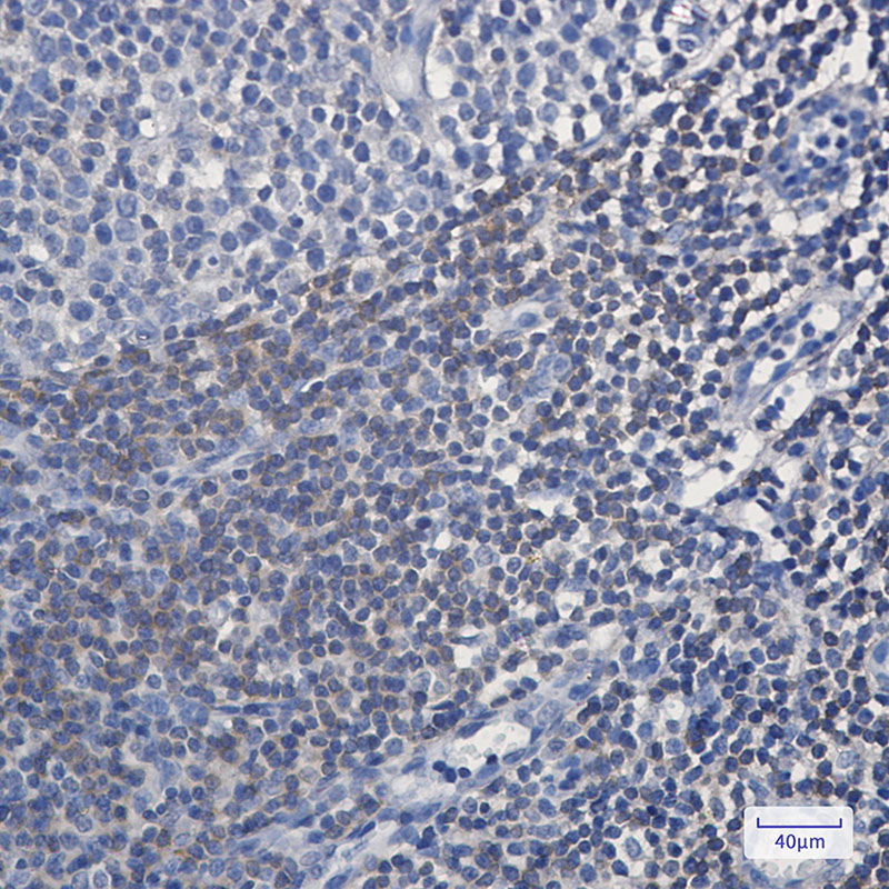 Rabbit Monoclonal Antibody to BIN1