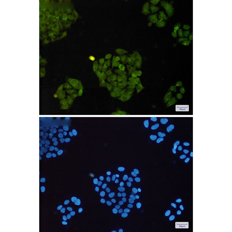 Rabbit Monoclonal Antibody to BRAT1