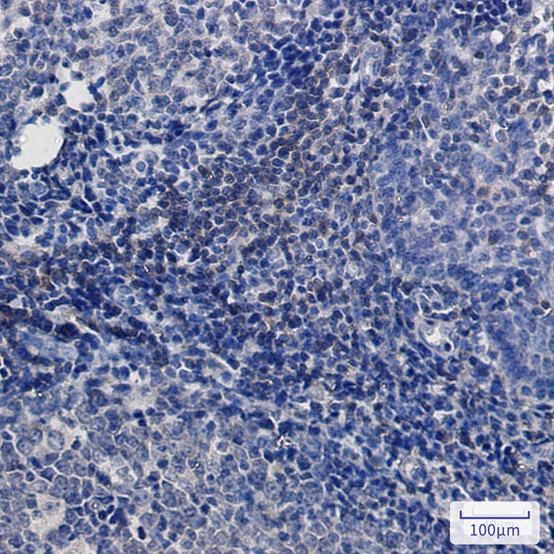 Rabbit Monoclonal Antibody to BTK