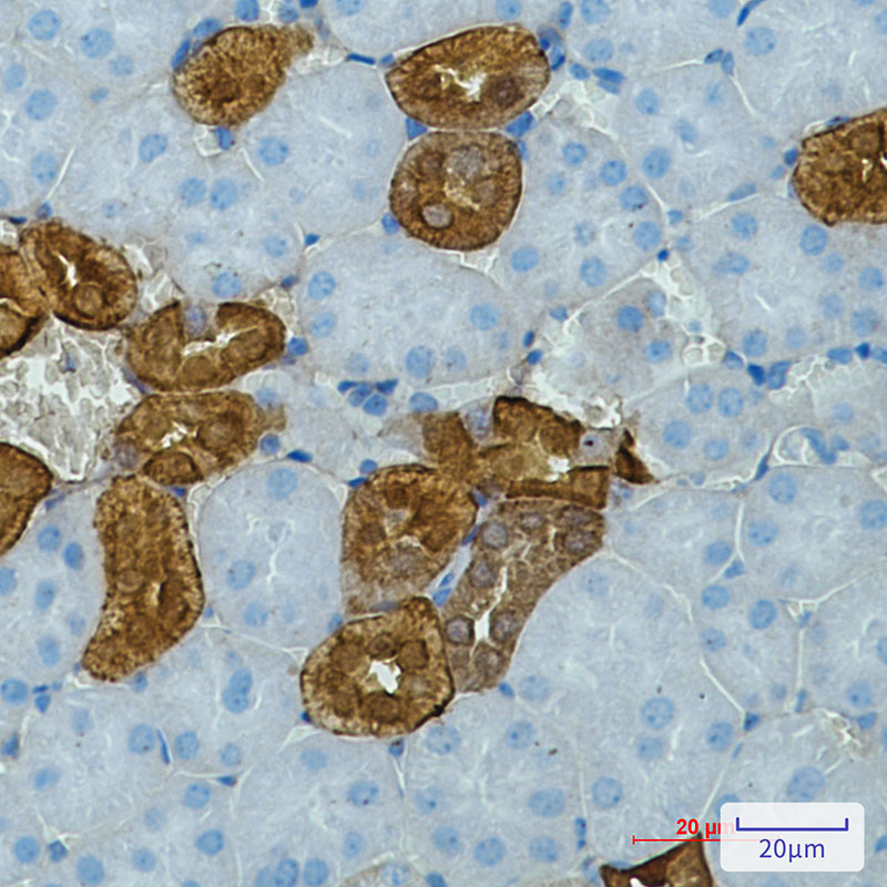 Rabbit Monoclonal Antibody to Calbindin