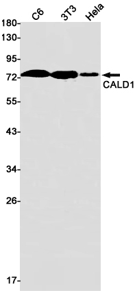 Caldesmon
