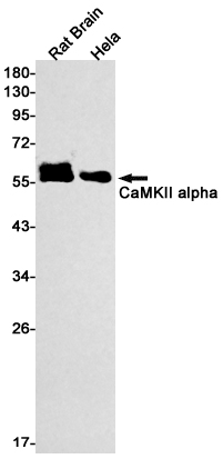 Rabbit Monoclonal Antibody to CaMKII alpha
