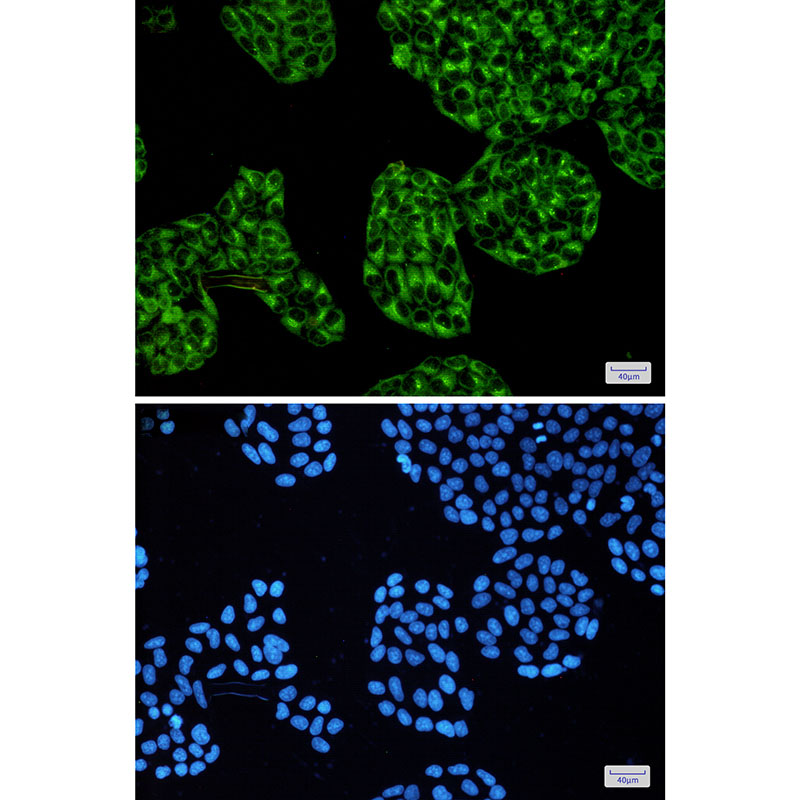Rabbit Monoclonal Antibody to cAMP Protein Kinase Catalytic Subunit