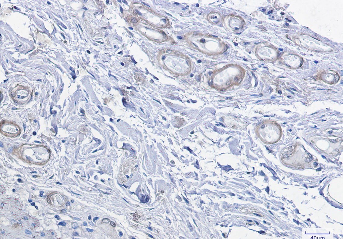 Rabbit Monoclonal Antibody to cAMP Protein Kinase Catalytic Subunit