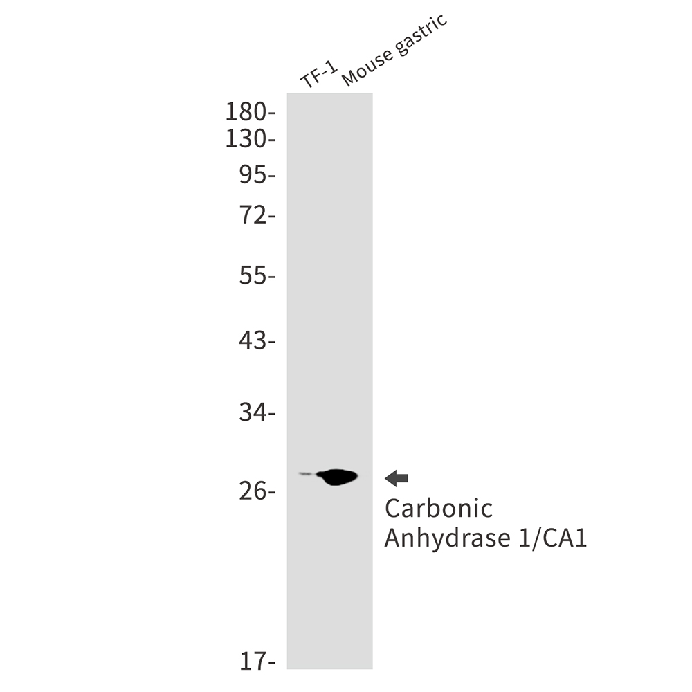 Carbonic Anhydrase 1