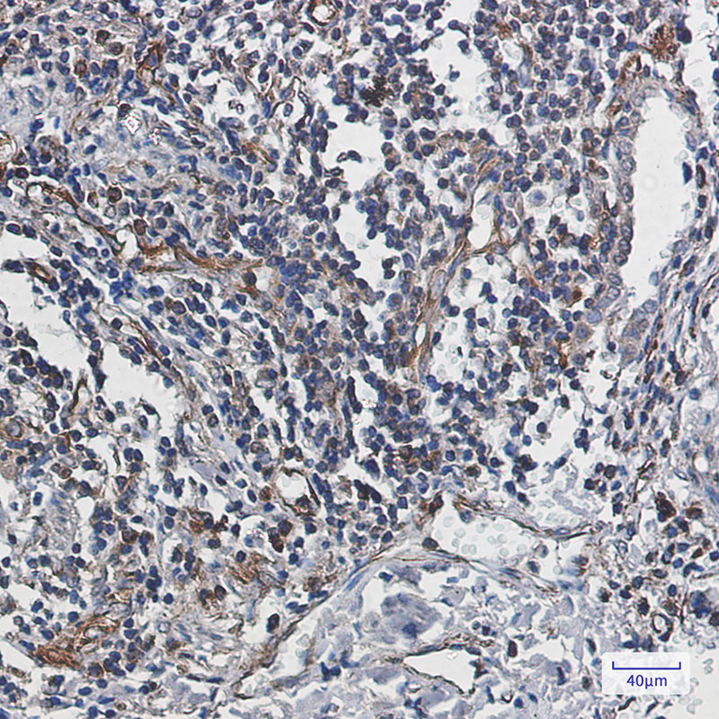 Rabbit Monoclonal Antibody to Caspase 10