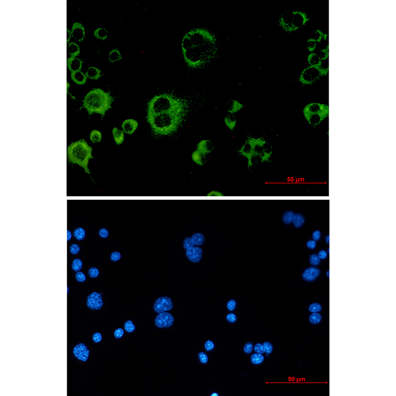 Rabbit Monoclonal Antibody to Catalase