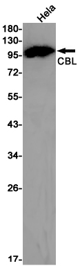 CBL
