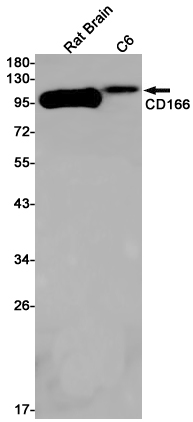 Rabbit Monoclonal Antibody to CD166