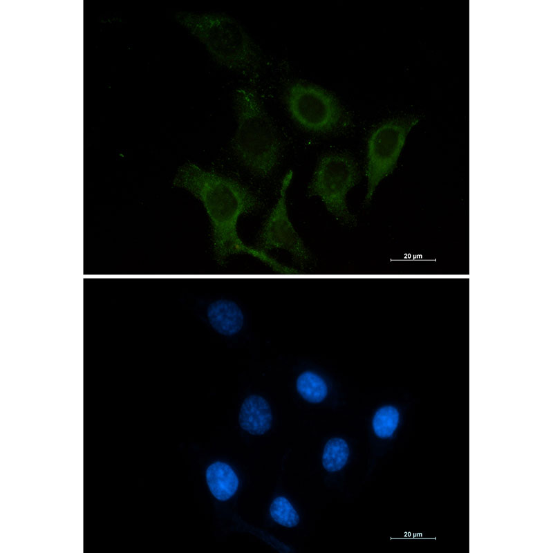 Rabbit Monoclonal Antibody to CD166
