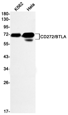 Rabbit Monoclonal Antibody to CD272