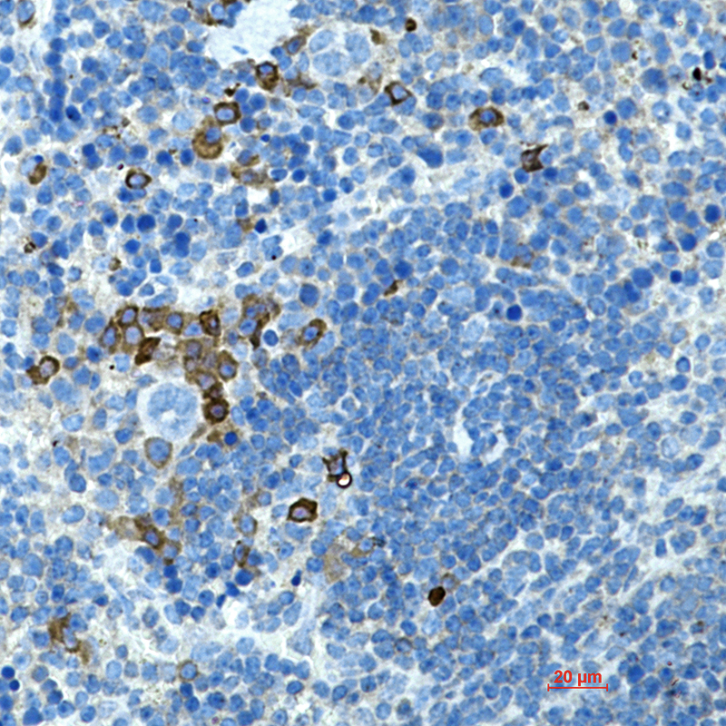 Rabbit Monoclonal Antibody to CD272
