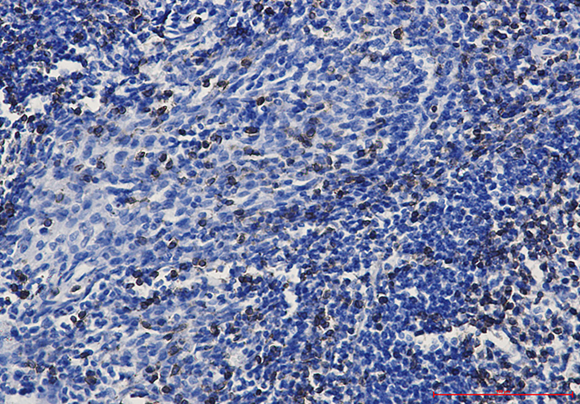 Rabbit Monoclonal Antibody to CD3 epsilon