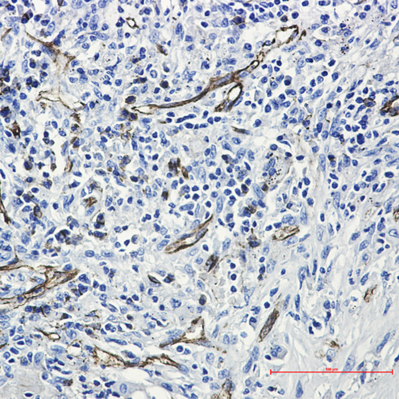 Rabbit Monoclonal Antibody to CD31