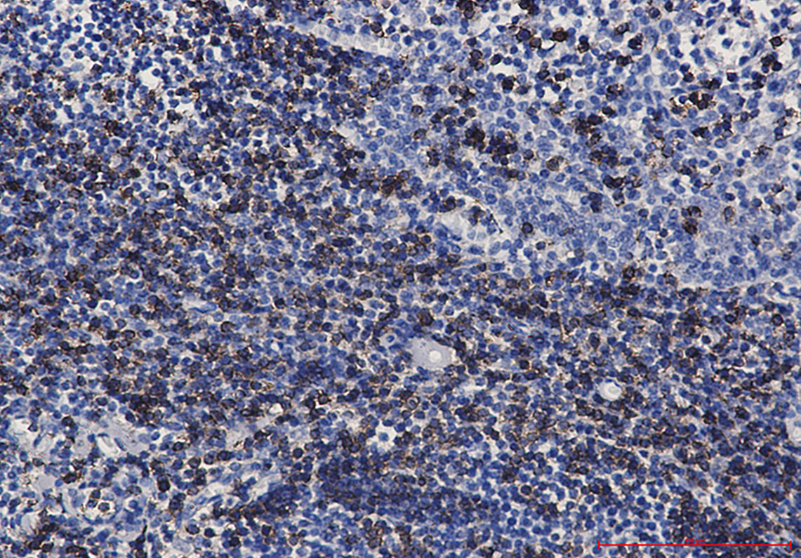 Rabbit Monoclonal Antibody to CD7