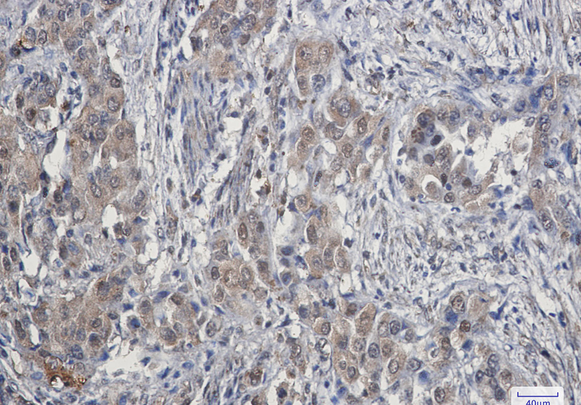 Rabbit Monoclonal Antibody to CDK4
