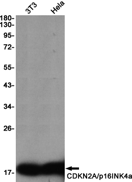 Rabbit Monoclonal Antibody to CDKN2A/p16INK4a