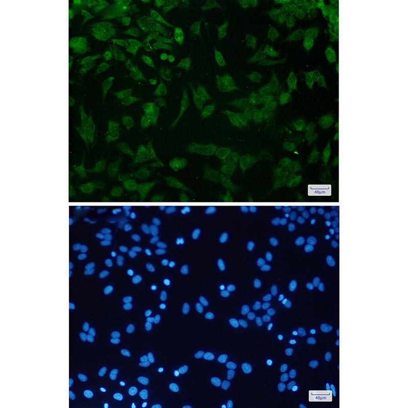 Rabbit Monoclonal Antibody to CDKN2A/p16INK4a