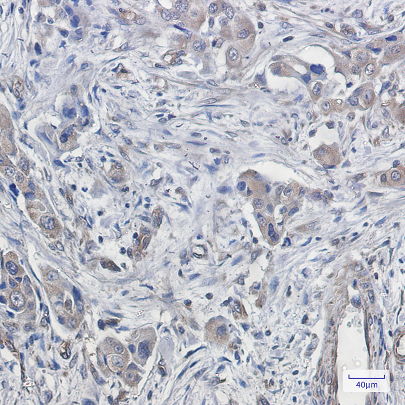 Rabbit Monoclonal Antibody to CDT2