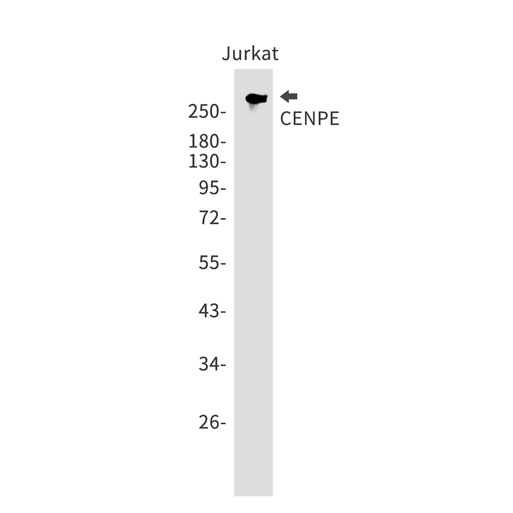 CENPE